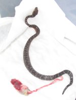 Neonate attached umbilicus.jpg