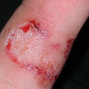 Who said leos do not bite, lol.