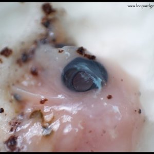 dead embryo