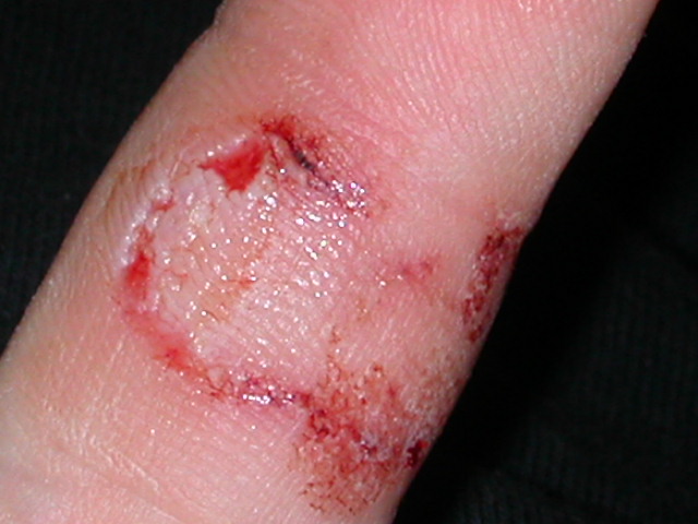 Who said leos do not bite, lol.